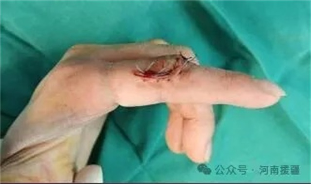 1762647208711644.jpg 微信图片_2025-11-09_074718_024.JPG